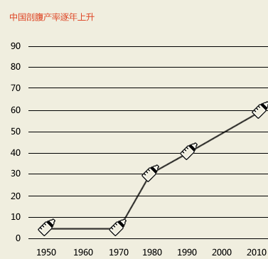 剖腹产
