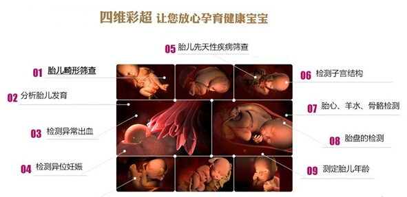 四维彩超