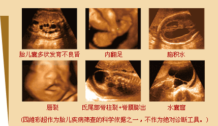 四维彩超费用