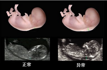 系统彩超